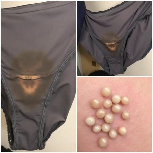 BE CAREFUL, If you spot these dots on your skin, it means you have Ca…